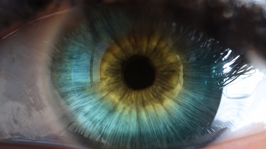 A photograph of an eye.